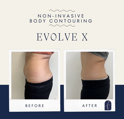 EvolveX Before and After